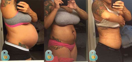 32-Charlytta-D-Bellefit-Results-Before-and-After-Bellefit-SLIDE