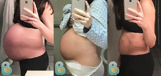 320-Maria-R-Bellefit-Results-Before-and-After-Bellefit-SLIDE