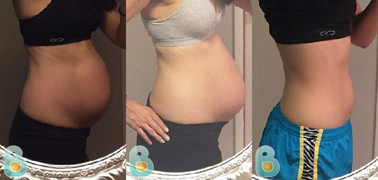 322-Kassidy-K-Bellefit-Results-Before-and-After-Bellefit-SLIDE