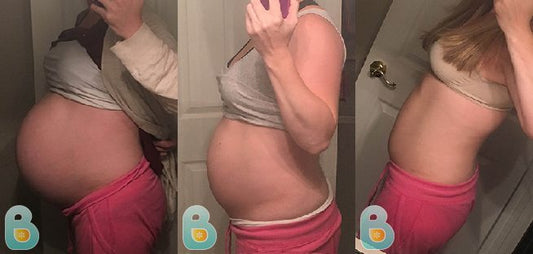 324-Stacy-C-Bellefit-Results-Before-and-After-Bellefit-SLIDE