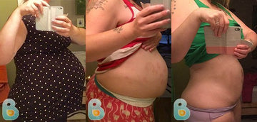 327-Monica-W-Bellefit-Results-Before-and-After-Bellefit-SLIDE