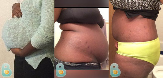 328-Jessica-S-Bellefit-Results-Before-and-After-Bellefit-SLIDE