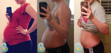 33-Chelsea-M-Bellefit-Results-Before-and-After-Bellefit-SLIDE