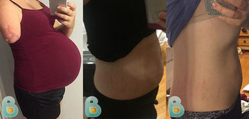 330-Danielle-S-Bellefit-Results-Before-and-After-Bellefit-SLIDE