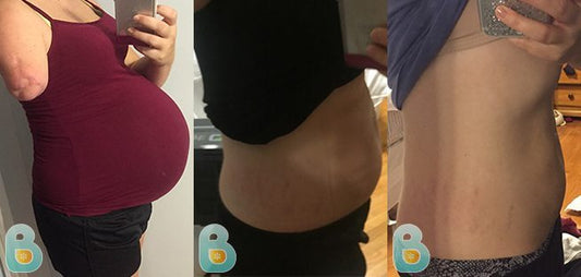 330-Danielle-S-Bellefit-Results-Before-and-After-Bellefit-SLIDE