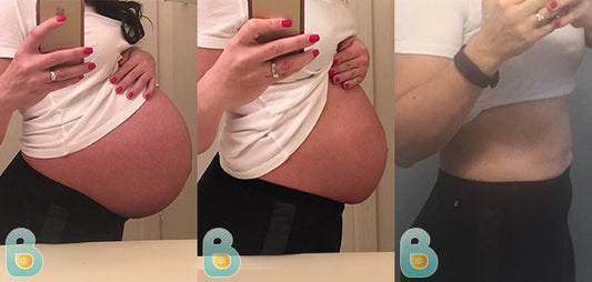 331-Abdaliz-G-Bellefit-Results-Before-and-After-Bellefit-SLIDE