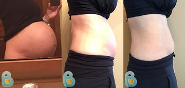 332-Beth-R-Bellefit-Results-Before-and-After-Bellefit-SLIDE
