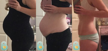 335-Victoria-W-Bellefit-Results-Before-and-After-Bellefit-SLIDE