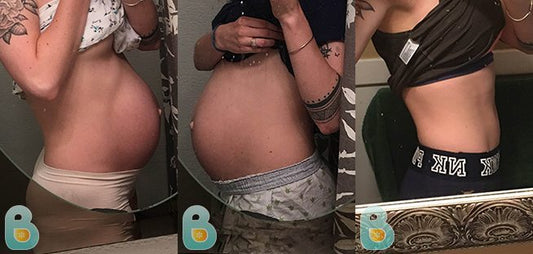 337-Caitlin-K-Bellefit-Results-Before-and-After-Bellefit-SLIDE