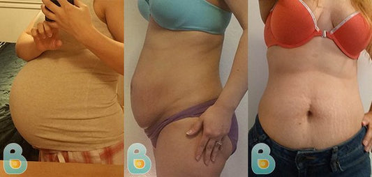338-Latosha-S-Bellefit-Results-Before-and-After-Bellefit-SLIDE