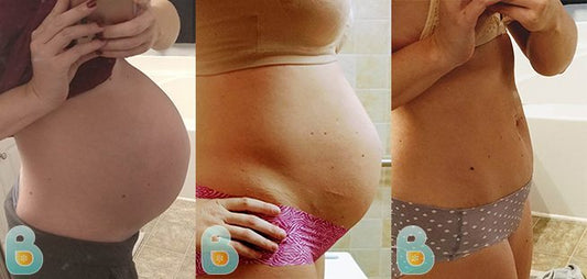 339-Marlee-F-Bellefit-Results-Before-and-After-Bellefit-SLIDE