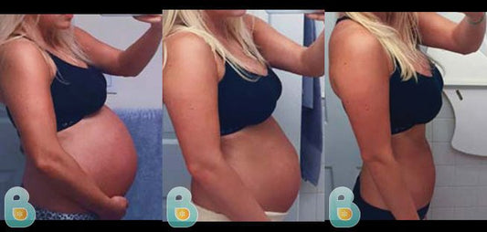 34-Christine-A-Bellefit-Results-Before-and-After-Bellefit-SLIDE