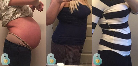 341-Evangelina-G-Bellefit-Results-Before-and-After-Bellefit-SLIDE