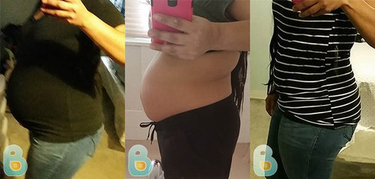 342-Leticia-P-Bellefit-Results-Before-and-After-Bellefit-SLIDE