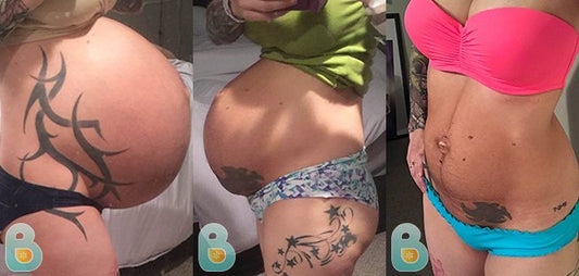 344-Nicole-L-Bellefit-Results-Before-and-After-Bellefit-SLIDE