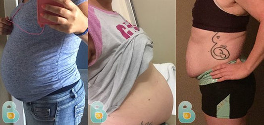 345-Cole-G-Bellefit-Results-Before-and-After-Bellefit-SLIDE