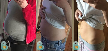 347-Jillian-O-Bellefit-Results-Before-and-After-Bellefit-SLIDE
