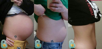 348-Susan-D-Bellefit-Results-Before-and-After-Bellefit-SLIDE