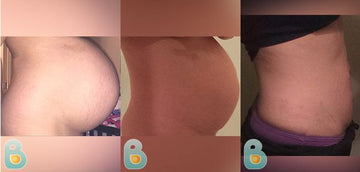 349-Jessica-F-Bellefit-Results-Before-and-After-Bellefit-SLIDE