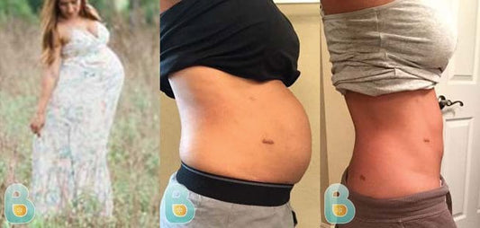 35-Cindy-S-Bellefit-Results-Before-and-After-Bellefit-SLIDE