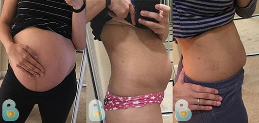 352-Marianne-M-Bellefit-Results-Before-and-After-Bellefit-SLIDE