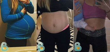 353-Breana-K-Bellefit-Results-Before-and-After-Bellefit-SLIDE