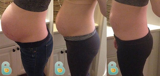 354-Sharon-L-Bellefit-Results-Before-and-After-Bellefit-SLIDE