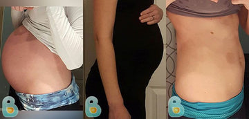 356-Charity-S-Bellefit-Results-Before-and-After-Bellefit-SLIDE