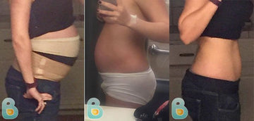 359-Caroline-S-Bellefit-Results-Before-and-After-Bellefit-SLIDE