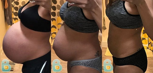 360-Karlyn-K-Bellefit-Results-Before-and-After-Bellefit-SLIDE