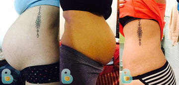 361-Rosa-E-Bellefit-Results-Before-and-After-Bellefit-SLIDE