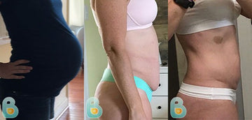 362-Patty-J-Bellefit-Results-Before-and-After-Bellefit-SLIDE