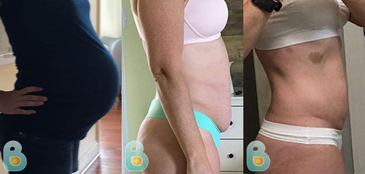 362-Patty-J-Bellefit-Results-Before-and-After-Bellefit-SLIDE