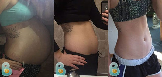 365-Elise-H-Bellefit-Results-Before-and-After-Bellefit-SLIDE