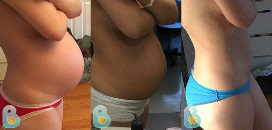 367-Grace-H-Bellefit-Results-Before-and-After-Bellefit-SLIDE