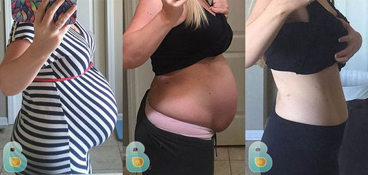 369-Susanne-M-Bellefit-Results-Before-and-After-Bellefit-SLIDE