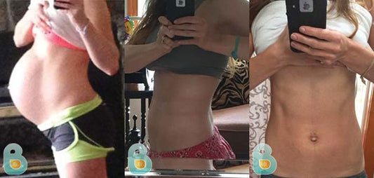 37-Colleen-C-Bellefit-Results-Before-and-After-Bellefit-SLIDE