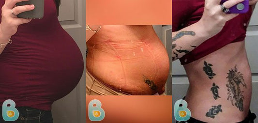 370-Jessica-H-Bellefit-Results-Before-and-After-Bellefit-SLIDE