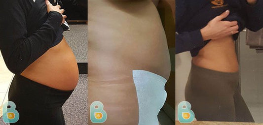 371-Jill-H-Bellefit-Results-Before-and-After-Bellefit-SLIDE