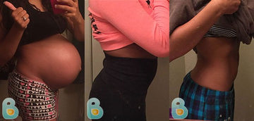 372-Chanelle-A-Bellefit-Results-Before-and-After-Bellefit-SLIDE