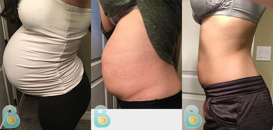 373-Kimberly-R-Bellefit-Results-Before-and-After-Bellefit-SLIDE