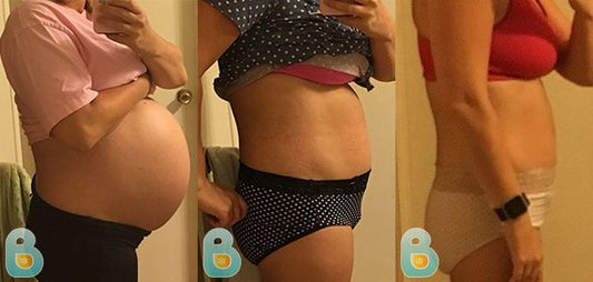 374-Allison-I-Bellefit-Results-Before-and-After-Bellefit-SLIDE