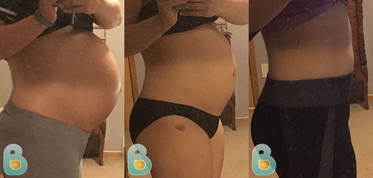 376-Alex-S-Bellefit-Results-Before-and-After-Bellefit-SLIDE