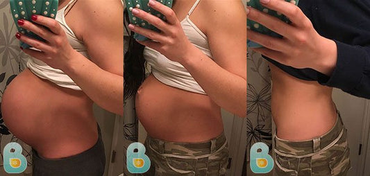 377-Autumn-R-Bellefit-Results-Before-and-After-Bellefit-SLIDE