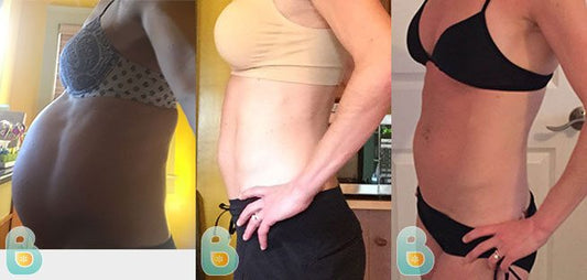 378-Sarah-G-Bellefit-Results-Before-and-After-Bellefit-SLIDE
