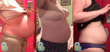 379-Chelsea-M-Bellefit-Results-Before-and-After-Bellefit-SLIDE