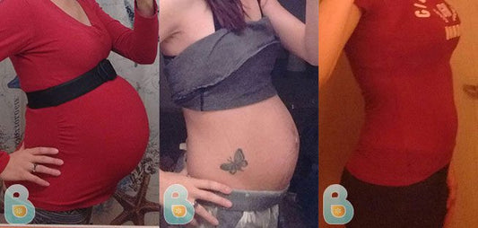 382-Asha-L-Bellefit-Results-Before-and-After-Bellefit-SLIDE