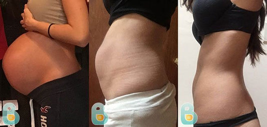 384-Crystal-M-Bellefit-Results-Before-and-After-Bellefit-SLIDE