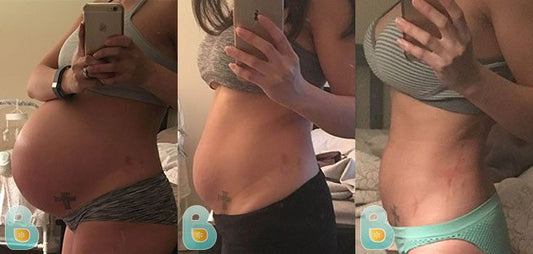 385-Kathryn-P-Bellefit-Results-Before-and-After-Bellefit-SLIDE