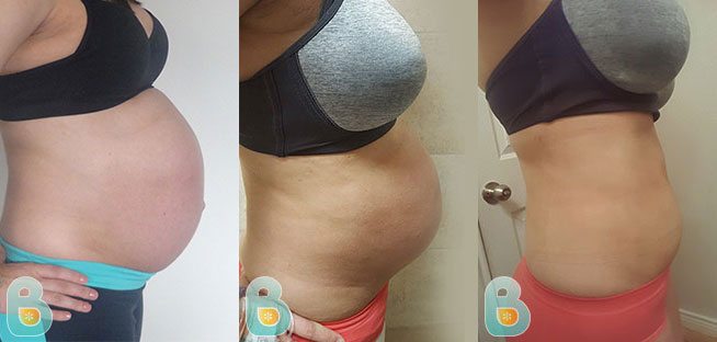 Abdomen Flat After BirthBellefit Postpartum Girdle and Corsets
